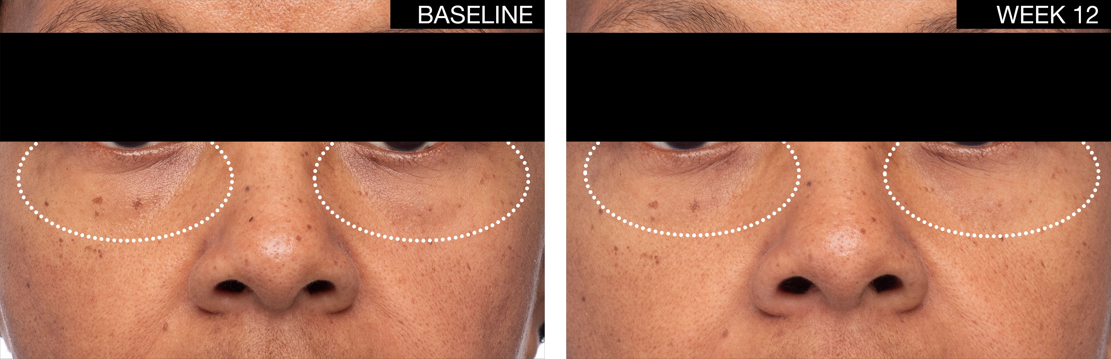 The Perfect Plump Cream
