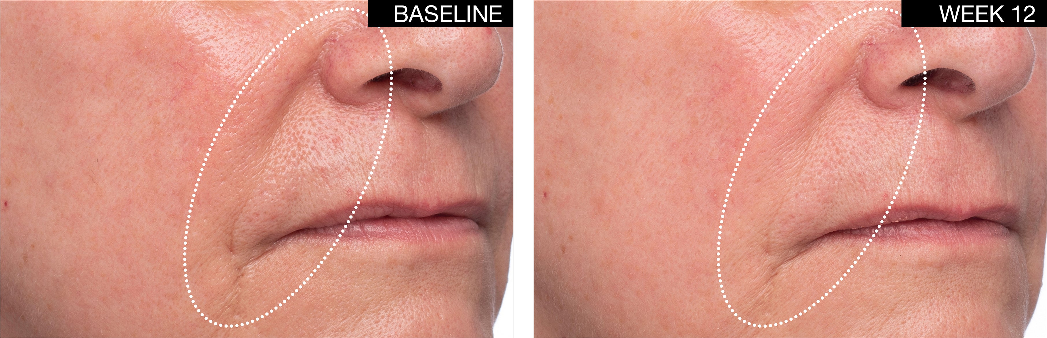 The Perfect Plump Cream